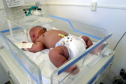Riesenbaby in Brasilien geboren
